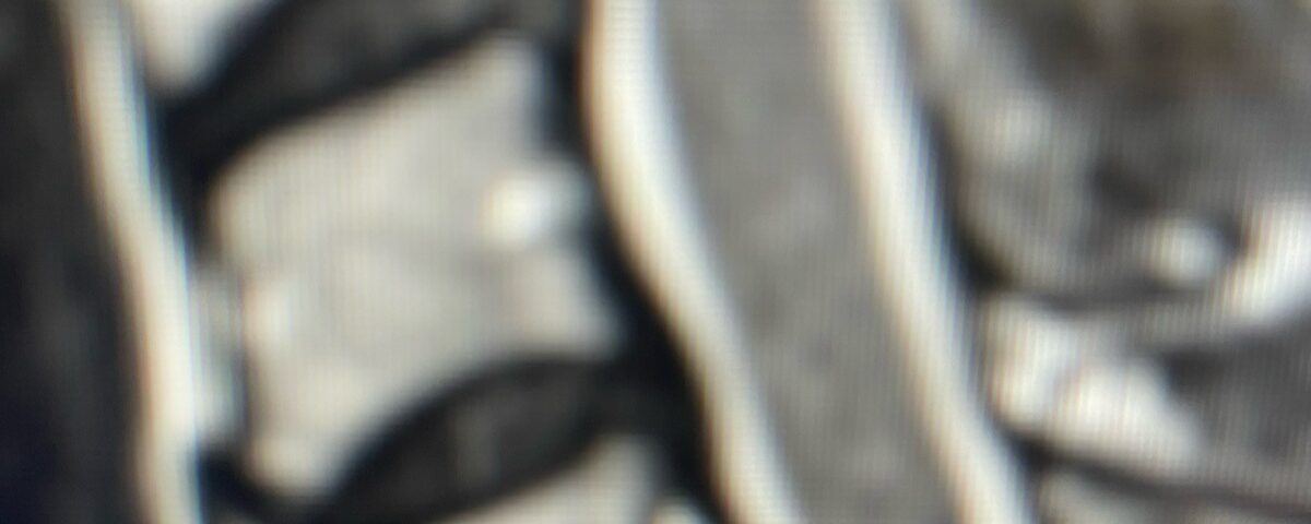 fig 7a