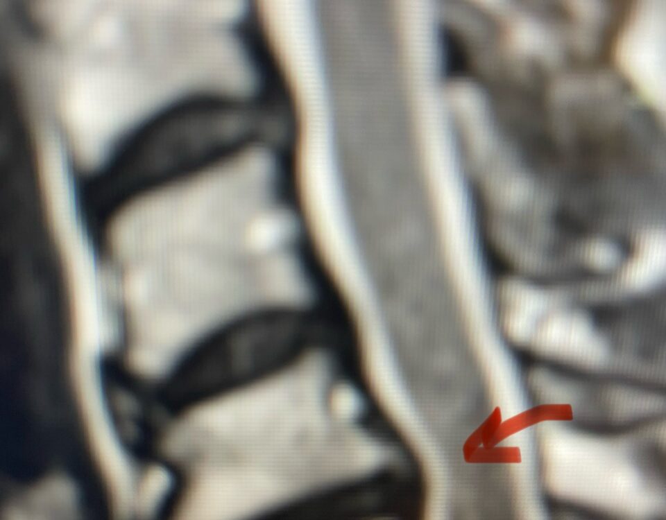 fig 7a